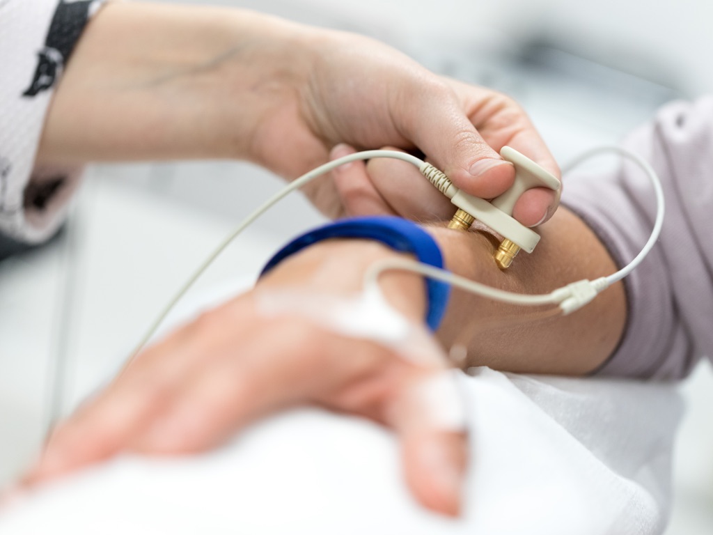 Elektroneurografie (NLG) › ZNS Mannheim